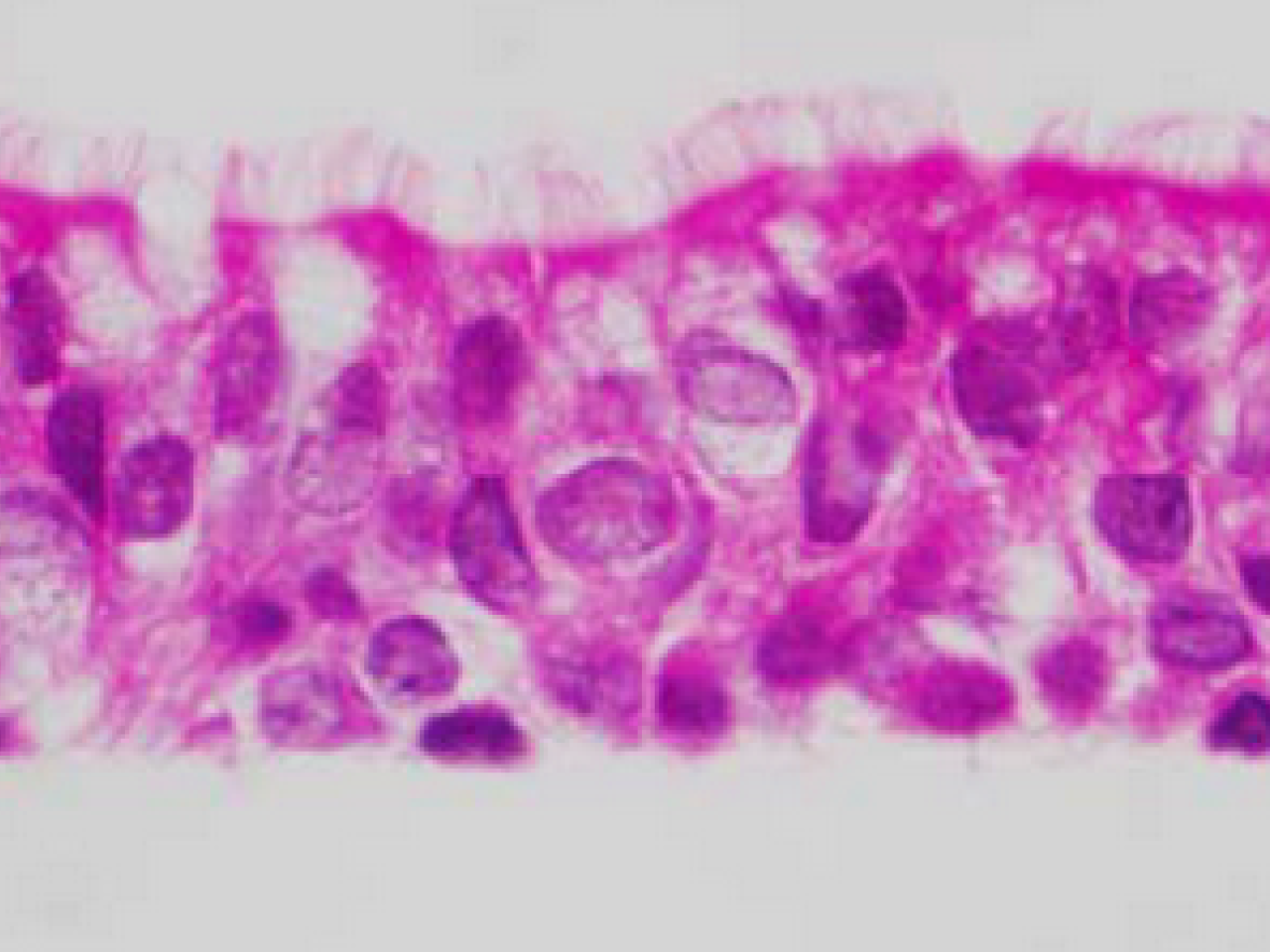 Human Airway Epithelial Biology