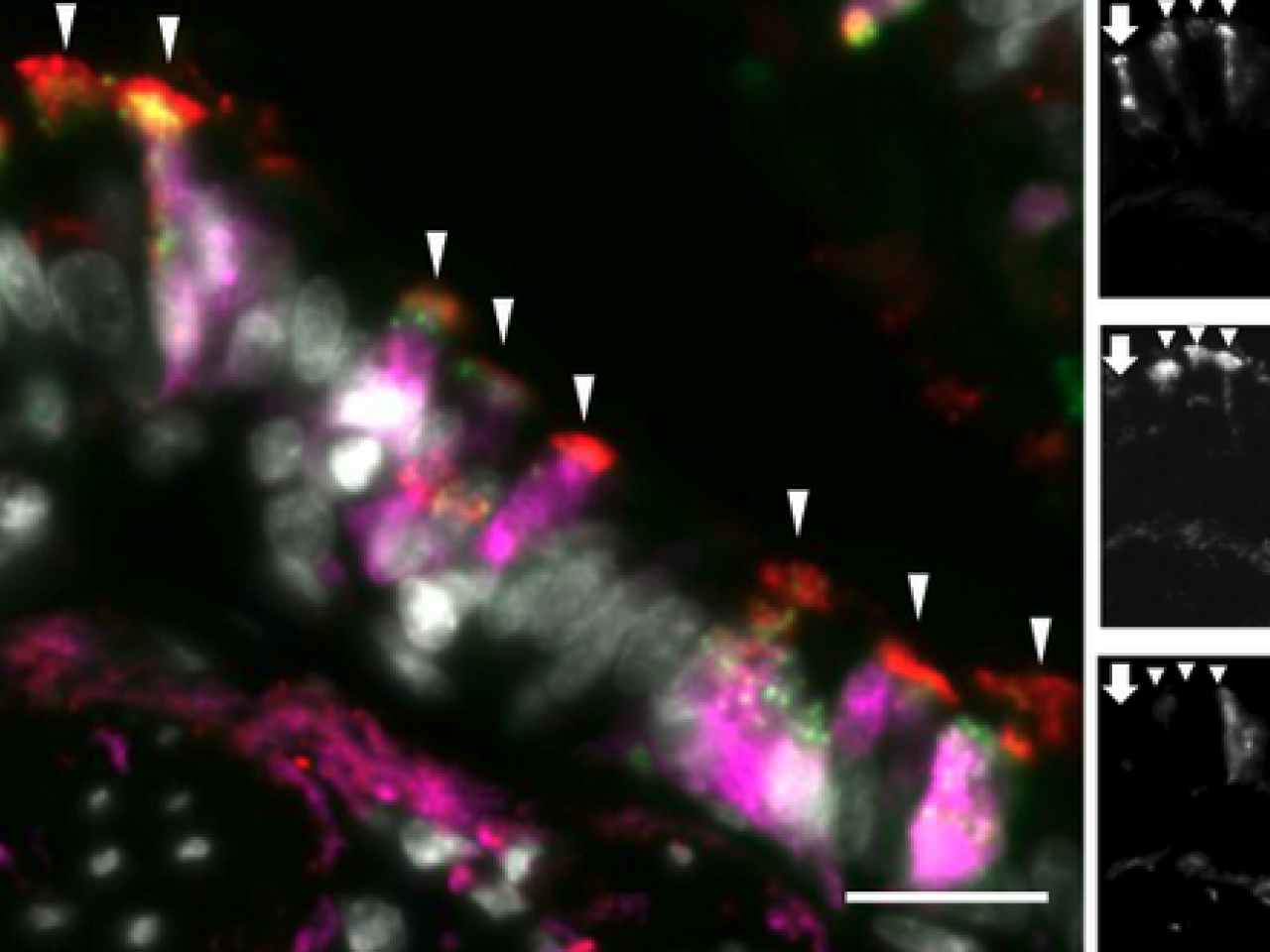 Human airway epithelial tissue co-stained for 3 markers of airway club cells